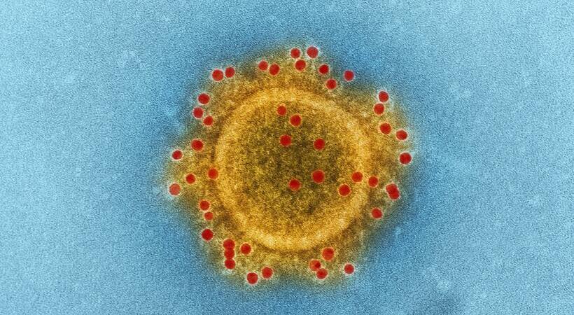  Vírus com cores fantasia visto através de um microscópio. Somente para ilustração: não é o vírus Monkeypox. 